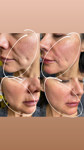 Lifted Beauty Medical Practice image
