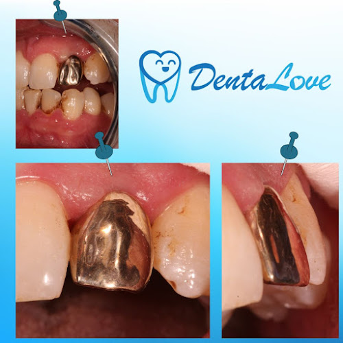 Nyitvatartás: DentaLove