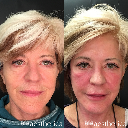 Explore dark hand tattoo ideas, creative tattoo ideas in Pleasant Grove, available at Aesthetica