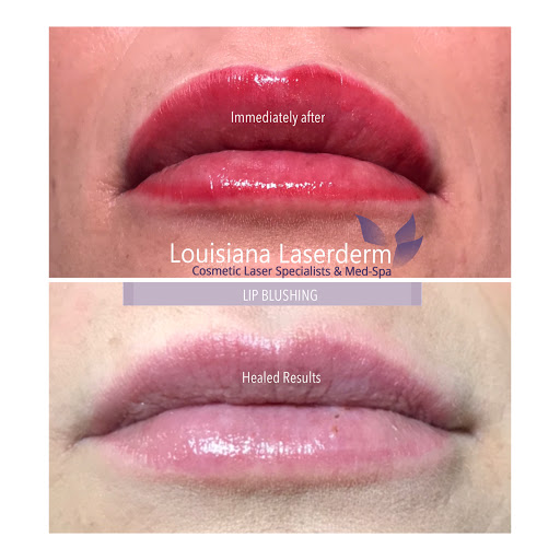 Explore koi sleeve tattoo ideas, creative tattoo ideas in Baton Rouge, available at Louisiana Laserderm