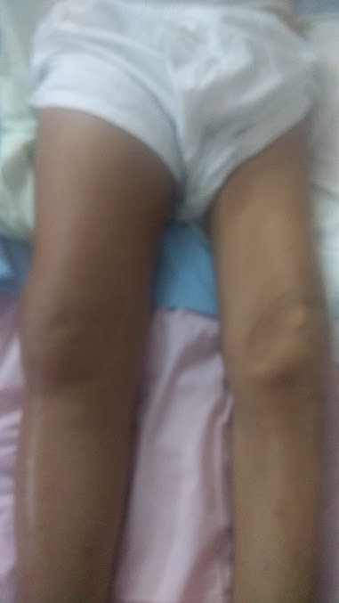 PhysioPort Delhi Physiotherapy Services - PhysioPort Delhi Physiotherapy Services