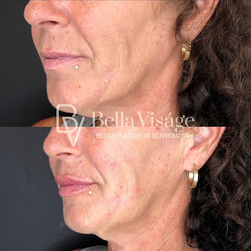 Explore cool sleeve tattoo ideas for guys, creative tattoo ideas in Lakeland, available at Bella Visge Medical & Aesthetic Rejuvenation