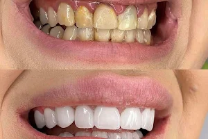 ‏Smile Designers Dental Center مركز مصممي الإبتسامة لطب و تجميل الأسنان image