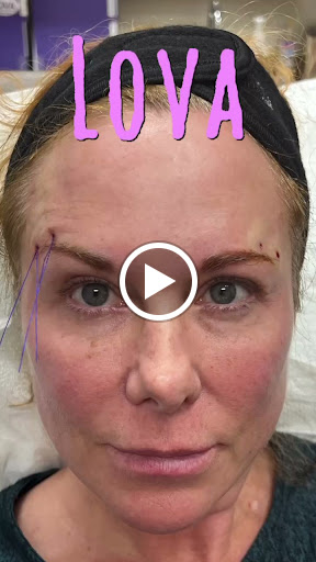 Explore gears of war tattoo ideas, creative tattoo ideas in Lake Oswego, available at Lake Oswego Vein and Aesthetic LOVA