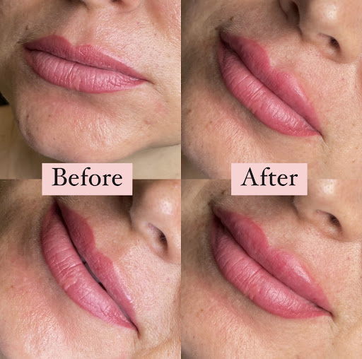 Lifted Beauty Medical Practice image