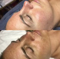 SPA SUITES by Jem Esthetics LLC - Photo 9 - Car repair in New Haven, CT, New Haven