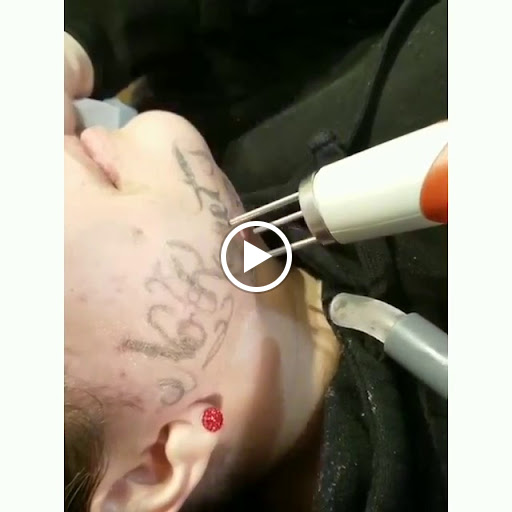 Explore cinderella tattoo ideas, creative tattoo ideas in Reno, available at Reno Tattoo Removal