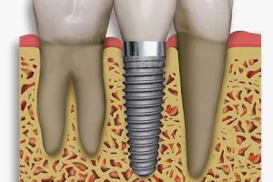 Atharva Multispeciality Dental Clinic image