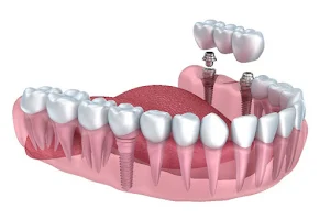 PearlFection Dentistry image