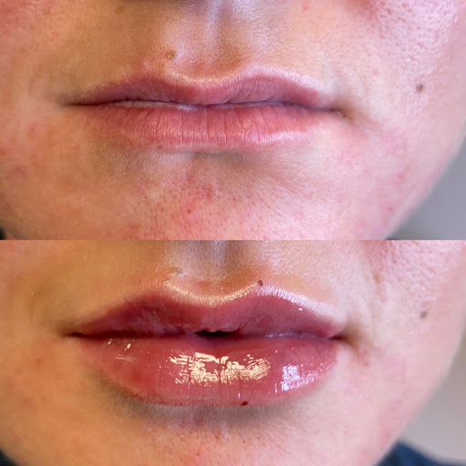 Explore crystal ball tattoo ideas, creative tattoo ideas in Canton, available at JDV Med Spa