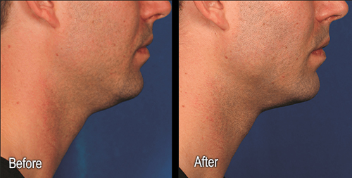 Explore drawing 49ers tattoo ideas, creative tattoo ideas in Sterling Heights, available at Skin & Vein Center