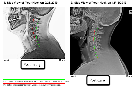 Chiropractor «40th Street Chiropractic», reviews and photos, 725 40th St, South Ogden, UT 84403, USA