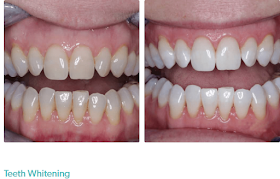 Perfect Smile Dental - Kensington