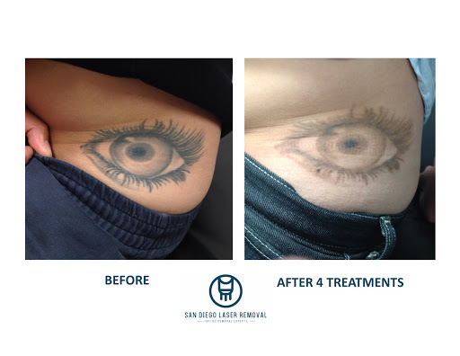 Explore hand mens tattoo ideas, creative tattoo ideas in San Diego, available at Removery Tattoo Removal & Fading