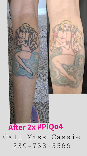 Explore next tattoo idea, creative tattoo ideas in Fort Myers, available at Miss Cassies laser tattoo removal