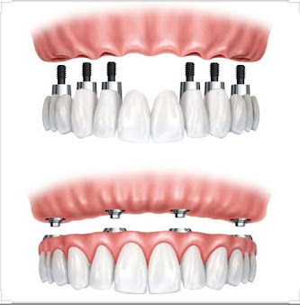 Dentastic Center for Advanced Dentistry - Dentastic Center for Advanced Dentistry