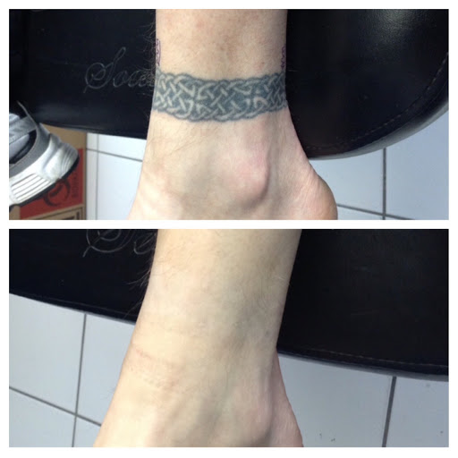 Explore meaningful first tattoo ideas, creative tattoo ideas in Lawrence, available at Removery Tattoo Removal & Fading