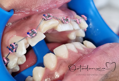 Ortodonzia Centro Odontológico