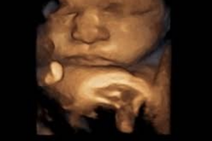 Miracle in motion ultrasound and reproductive center in Muncie image