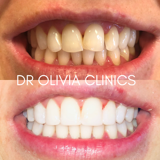 Dr Olivia Clinics | Cosmetic Dentist Belfast
