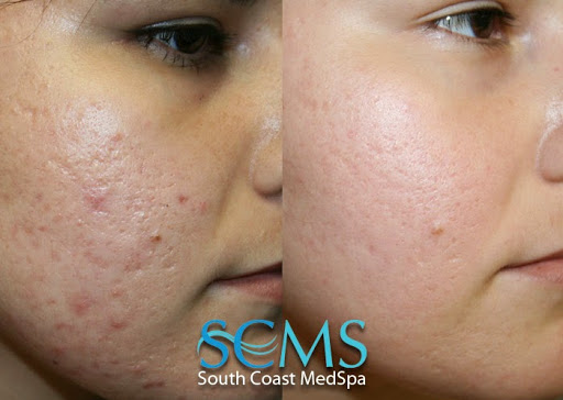 South Coast MedSpa image