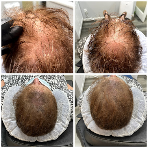 Explore hot guys tattoo ideas, creative tattoo ideas in Roseville, available at NuHair Ink. Scalp MicroPigmentation & Aesthetic Clinic of Sacramento