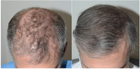 Foundation For Hair Restoration