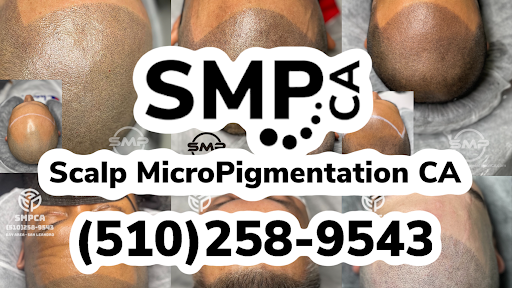 Scalp MicroPigmentation CA