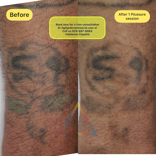 Explore tattoo ideas for dark skin men, creative tattoo ideas in New York, available at Ag2g Laser Tattoo Removal & MedSpa