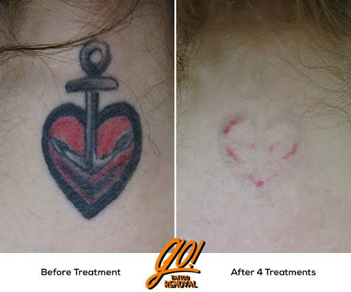 Explore small men tattoo ideas, creative tattoo ideas in Allentown, available at Removery Tattoo Removal & Fading