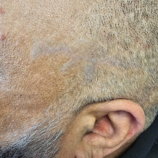 Explore spider-man tattoo ideas, creative tattoo ideas in Rochester, available at Rochester Tattoo Removal