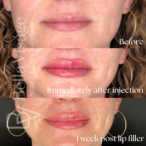 Explore neck tattoo ideas for woman, creative tattoo ideas in Lakeland, available at Bella Visge Medical & Aesthetic Rejuvenation