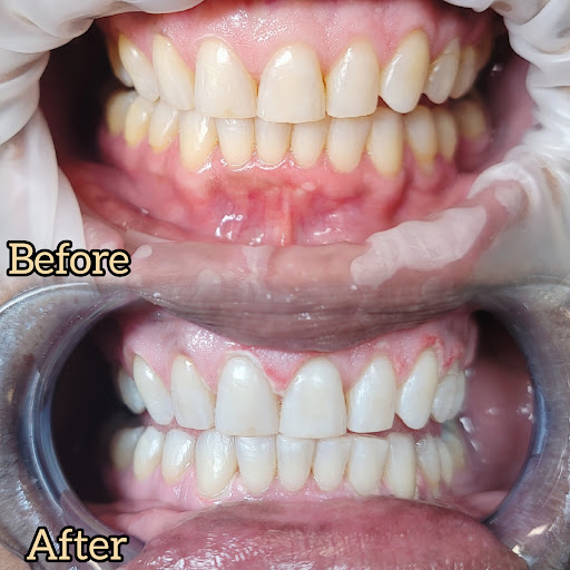 Explore alt tattoo ideas, creative tattoo ideas in Cambria Heights, available at Dreamfillz Microblading Eyelash Extensions Laser HairTattoo Removal