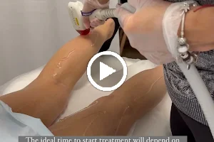 Beauty Laser Studio - Best laser Hair removal image