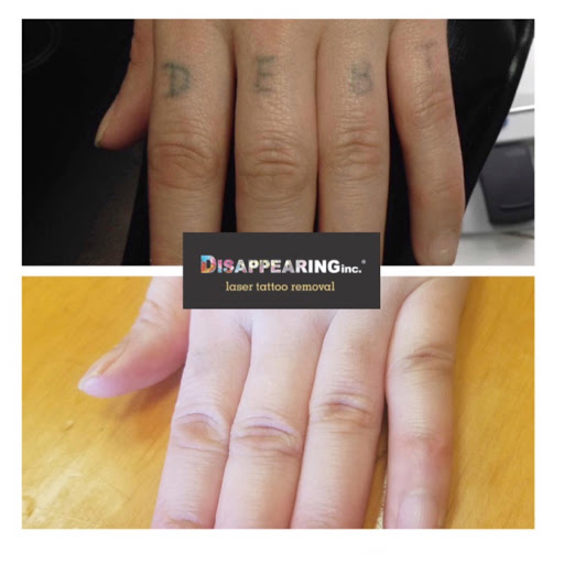 Find ideas for mom tattoos for your next unique tattoo in Lawrence at Removery Tattoo Removal & Fading