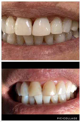 9456 Harding Ave, Surfside, FL 33154, USA