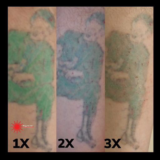 Explore bonsai tree tattoo ideas, creative tattoo ideas in Morrisville, available at Regerts Ink Removal