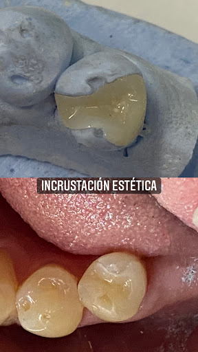 Periodoncista de implantes dentales Morelia