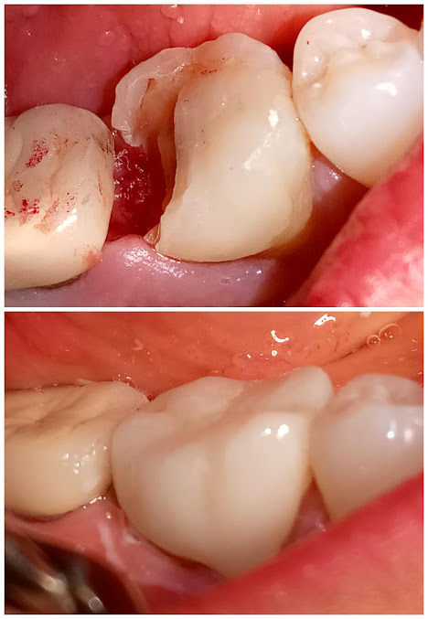 Dental 24/7 Emergencies - Dental 24/7 Emergencies