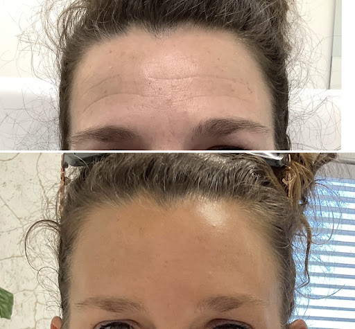 Explore gummy bear tattoo ideas, creative tattoo ideas in Owensboro, available at The Skin Lab