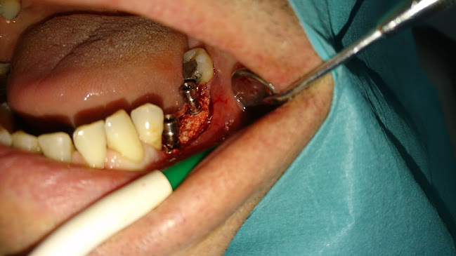 Opinii despre dr. med. dent. Imre Csapó M. Sc în Komárom - Fogászat