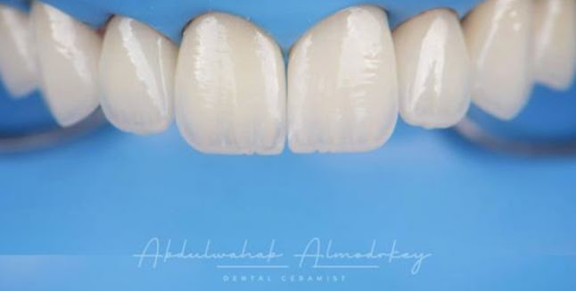Opinii despre معمل ايفكت لتركيبات الأسنان Effect dental lab în الرياض - مختبر
