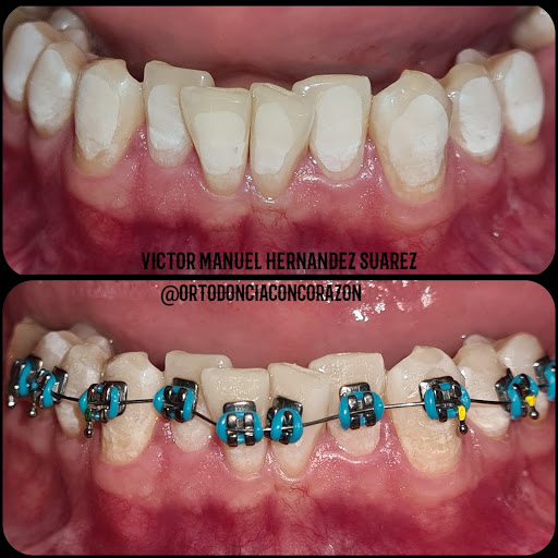 Clinica odontologica Corazon Dental
