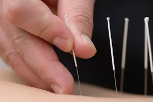 Three Peaks Physical Therapy, Massage and Acupuncture image