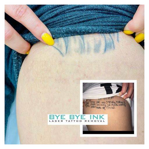 Explore pikachu tattoo ideas, creative tattoo ideas in Middle Village, available at Bye Bye Ink Laser Tattoo Removal