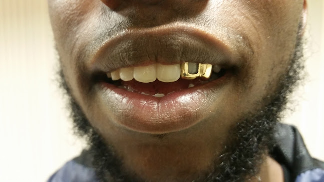 Mouth Full of Gold Ltd - Jewelry