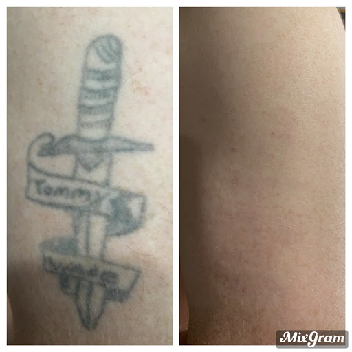 Explore trigun tattoo ideas, creative tattoo ideas in Tyler, available at Vanish Laser Aesthetics