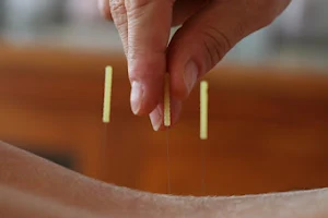 2 the Point Acupuncture image