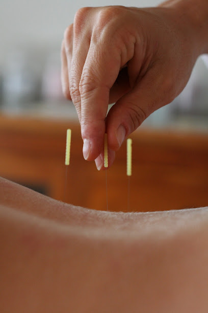 2 the Point Acupuncture