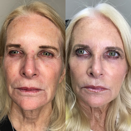 Explore tattoo ideas for legs, creative tattoo ideas in Canton, available at JDV Med Spa